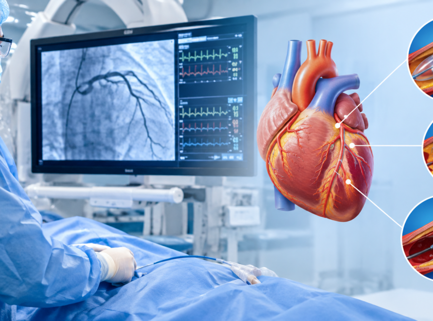 Interventional Cardiology: What Is It and When Might You Need It? hd